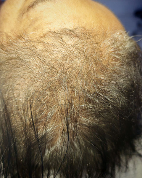 AQ Advanced Hair Complex+