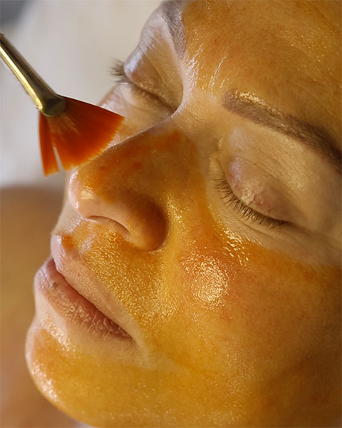 Medical Grade Chemical Peels