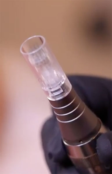 Microneedling